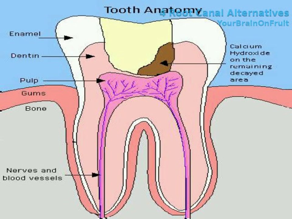 4 Root Canal Alternatives