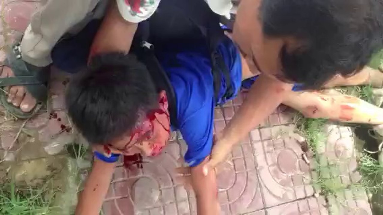 very dengerous accident by www.fullmufta.blogspot.com