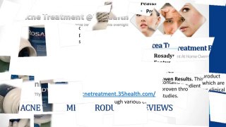 Rosadyn Rosacea Treatment Review