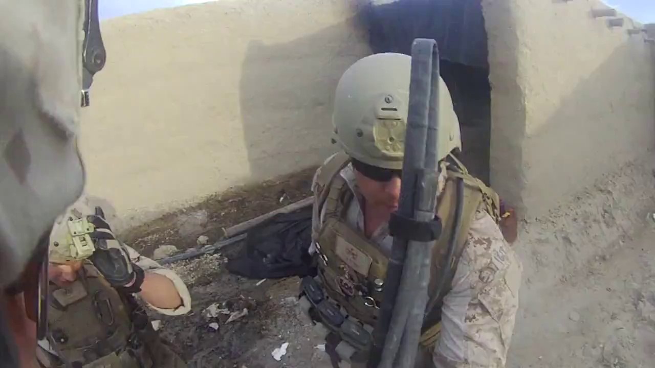 Souldier Survives a Shot in the Head