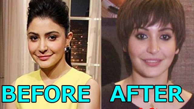 Mystery Behind Anushka Sharma's Lips