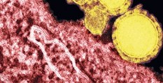 Sağlık Bakanlığı: Ölen İşçide MERS Virüsü Tespit Edildi