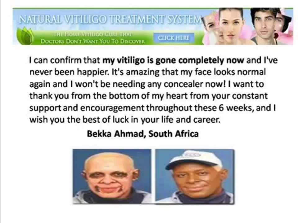 Natural Vitiligo Treatment System