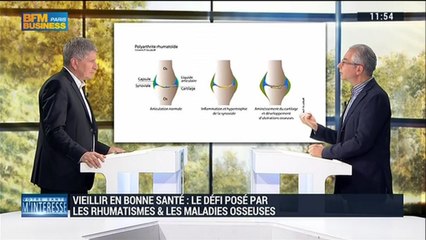 Vieillir en bonne santé: que peut-on faire contre les rhumatismes et les maladies osseuses ? - 18/10