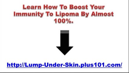 Cure Lipoma Naturally