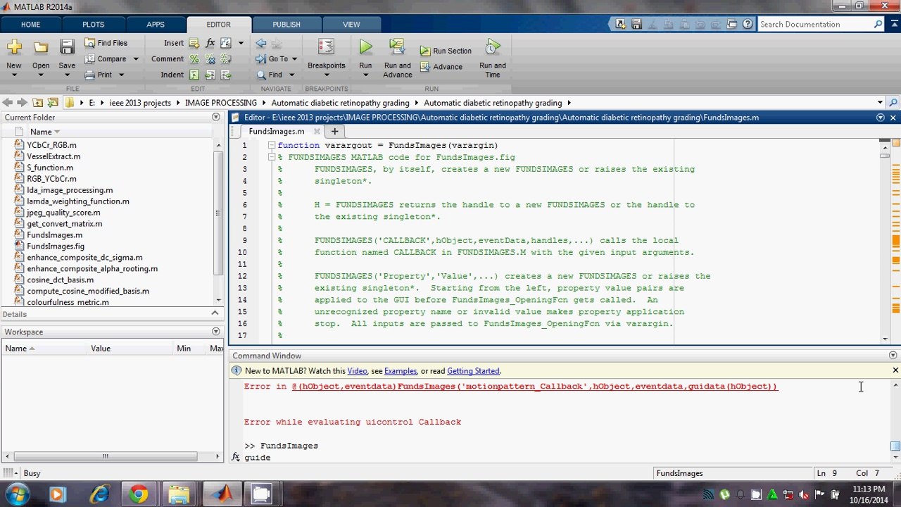 IEEE 2013 IP Automated detection of diabetic retinopathy in blurred digital fundus images