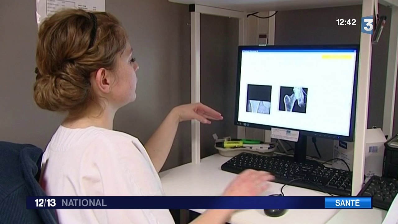 Santé : l’ostéoporose de mieux en mieux soignée