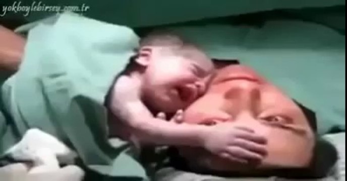 Un bébé refuse d'être séparé de sa mère dès sa naissance