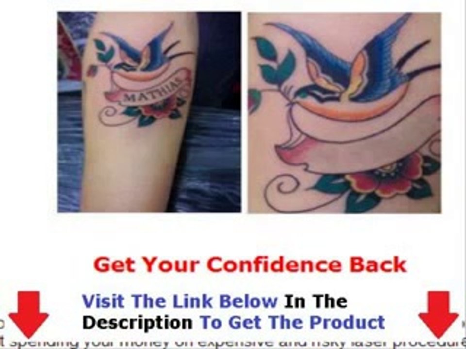 50% Off Get Rid Tattoo Bonus + Discount