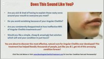 Angular Cheilitis Overnight Cure - Angular Cheilitis Treatment