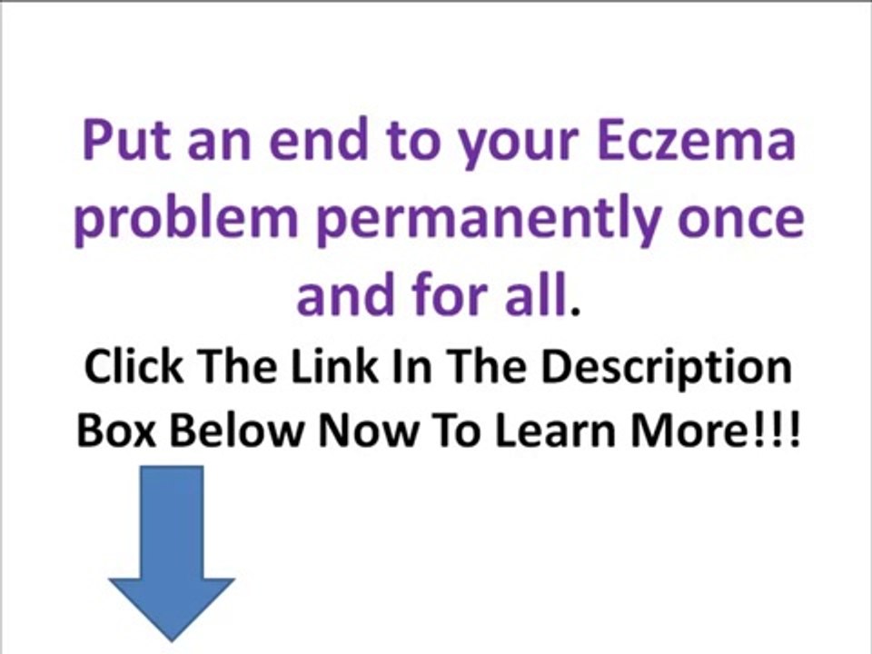 Beat Eczema Guide Review-Watch This Before You Buy!