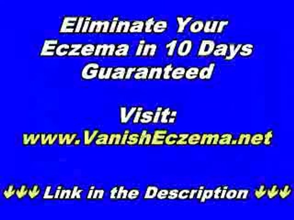 Three Natural Ways to Beat Eczema
