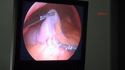 Samsun Kilo Vermek İçin Londra?dan Samsun?a Geldi