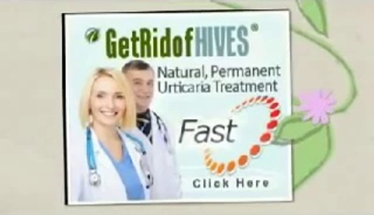 Diet To Get Rid Of Hives