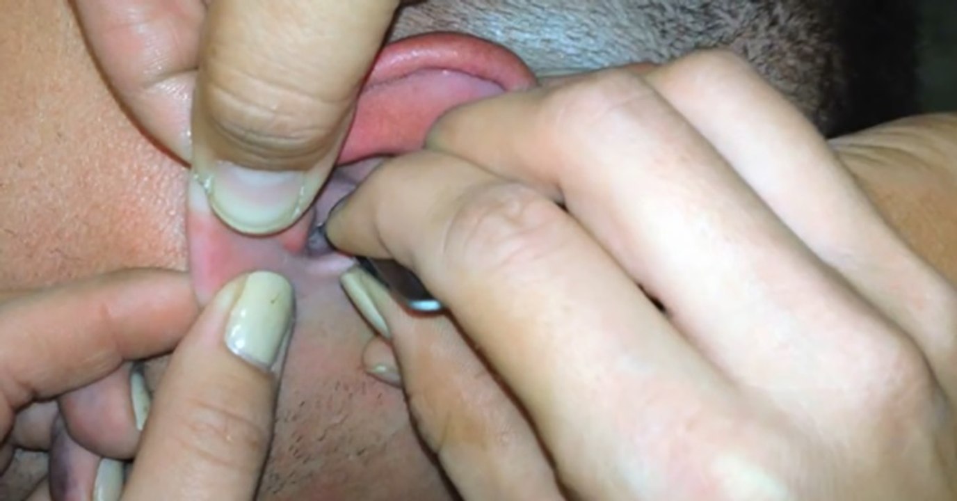 Adamın Başına Geleni izleyince Çok Şaşıracaksınız..