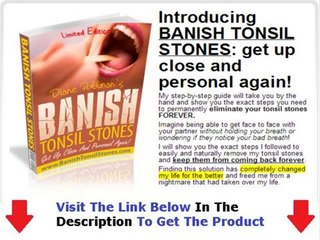 Banish Tonsil Stones Book Review + DISCOUNT + BONUS