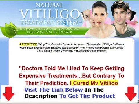 Natural Vitiligo Treatment System Shocking Review Bonus + Discount