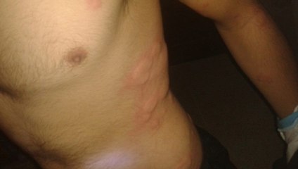 IŞİD Türkiye Sınırında Kimyasal Silah Kullandı