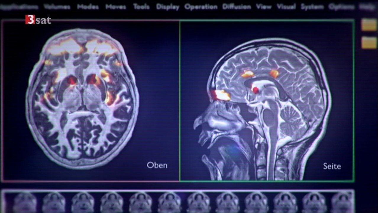 Nur Porno im Kopf - Suchtgefahr für Jugendliche