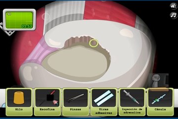 Operate Now  Knee Surgery Walkthrough