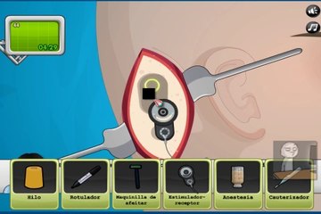Operate Now  Ear Surgery Walkthrough