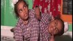 motivational story of conjoined Twins Sohna and Mohna