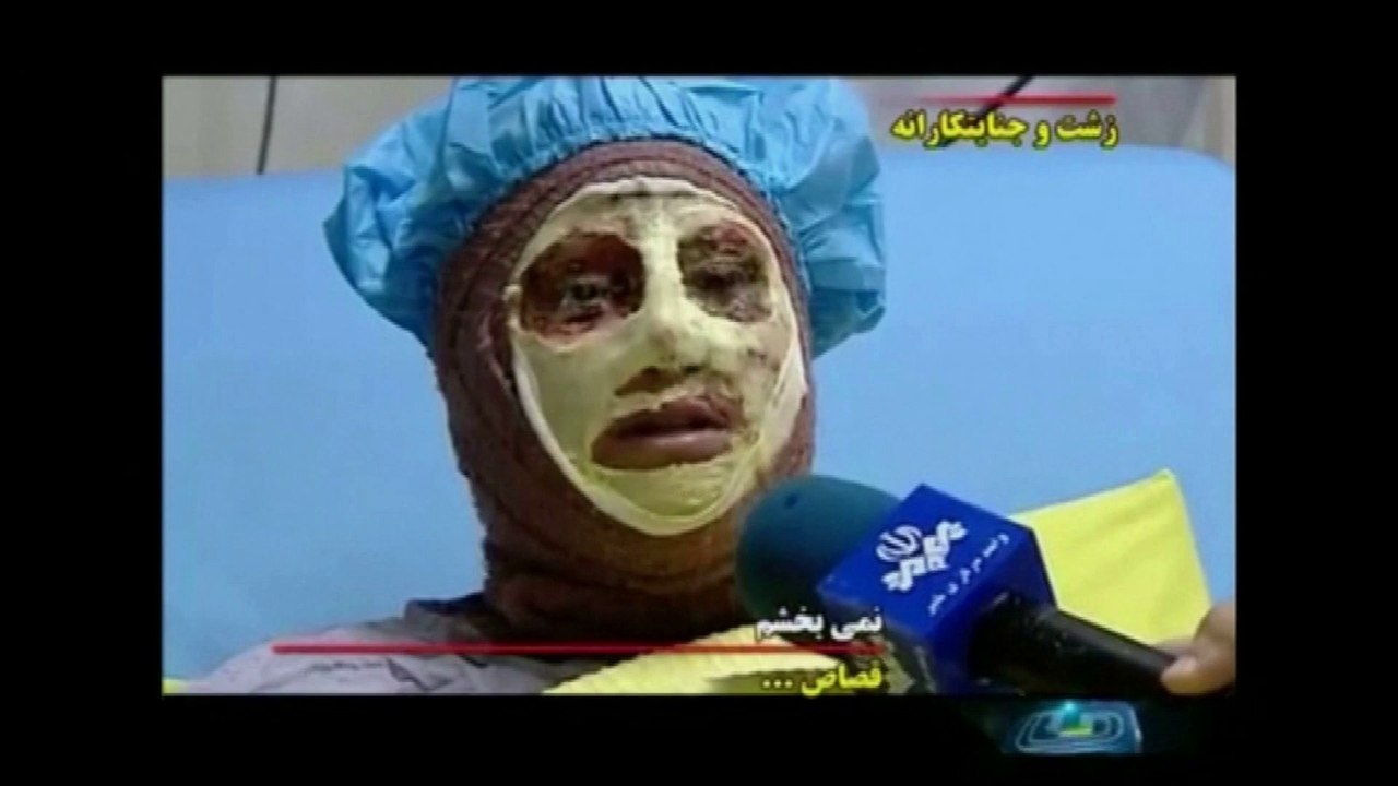 Des Iraniennes victimes d'attaques à l'acide témoignent à la télévision