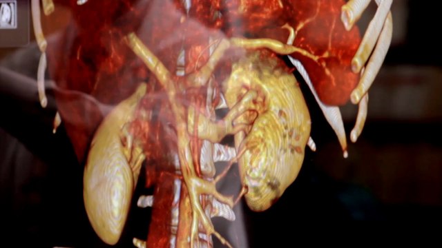 La table d'anatomie 3D multitouch