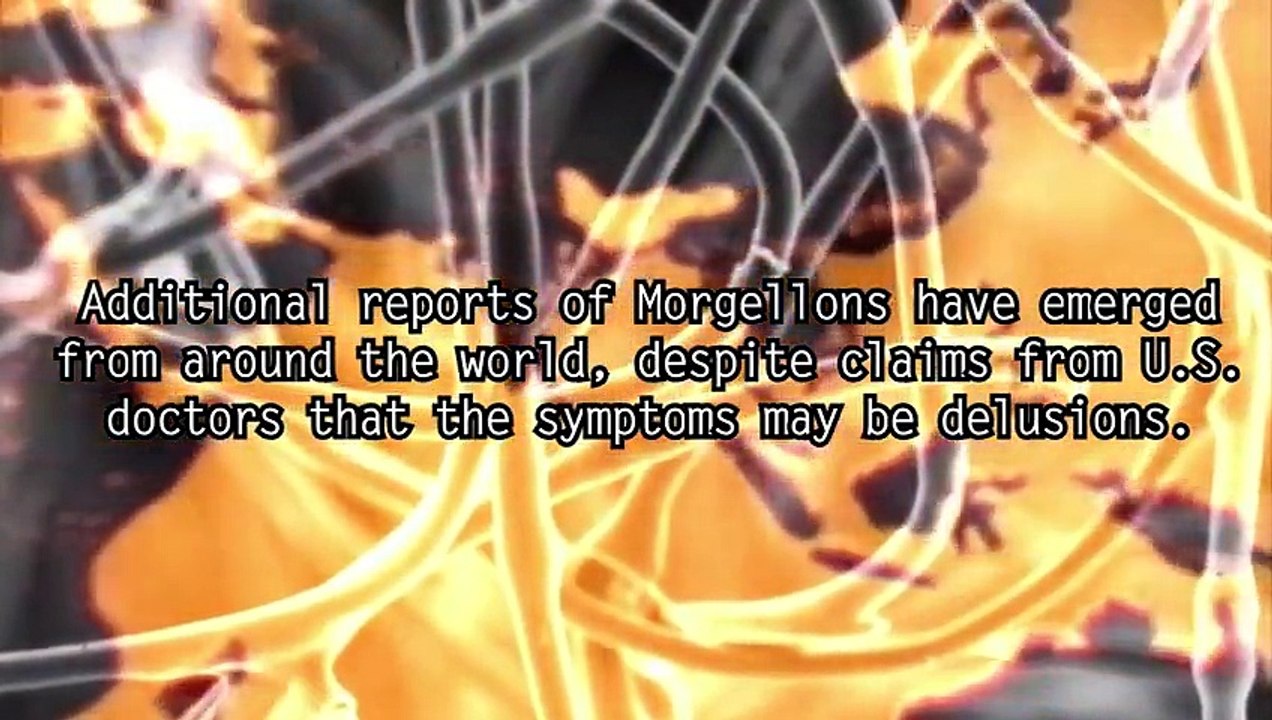 Five Strange-Diseases on the Planet