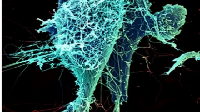 Rabies Vaccine Protects Nonhuman Primates Against Deadly Ebola Virus