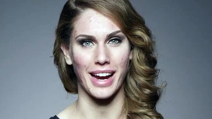 Cassandra Bankson, atteinte d'une maladie de la peau, explique pourquoi elle se maquille