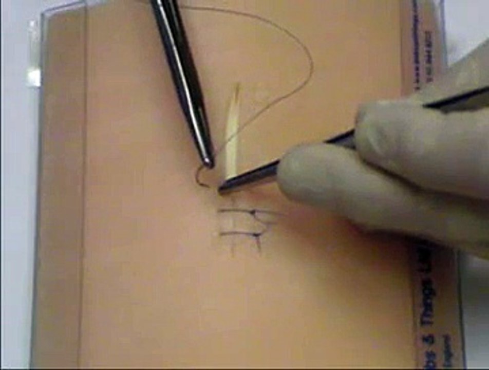 Skin Suture simple