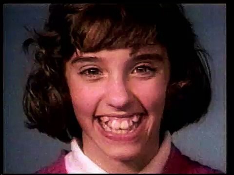 18 mois d’appareil dentaire en 25 secondes