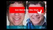 Acne Free In 3 Days - Acne Free In 3 Days Review [How to Acne Free In 3 Days]