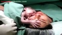 baby that after he born he didn't want to separate from his mom. AMAZING and EMOTIONAL