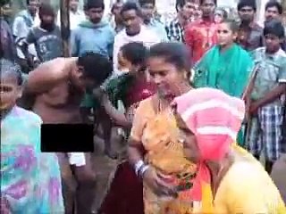 Girl Life Ruined By A Car Driver