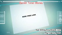 Banish Tonsil Stones By Diane Puttman - Banish Tonsil Stones By Diane Puttman
