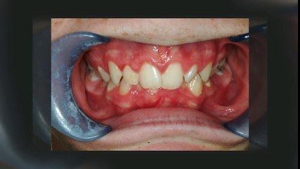 Duryea Littleton Orthodontics - (303) 933-0300