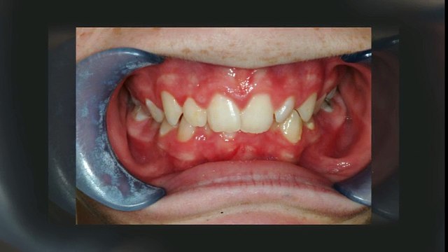 Duryea Littleton Orthodontics - (303) 933-0300