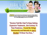 Top Vitiligo Cure! Natural Vitiligo Treatment System
