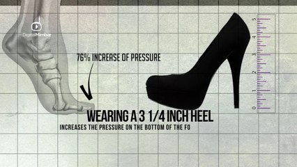 High Heels & its HARMFUL EFFECTS