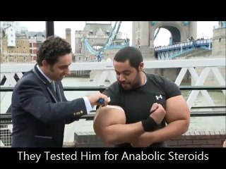 Largst Biceps World Record Holder Uses Synthol-EXPOSED