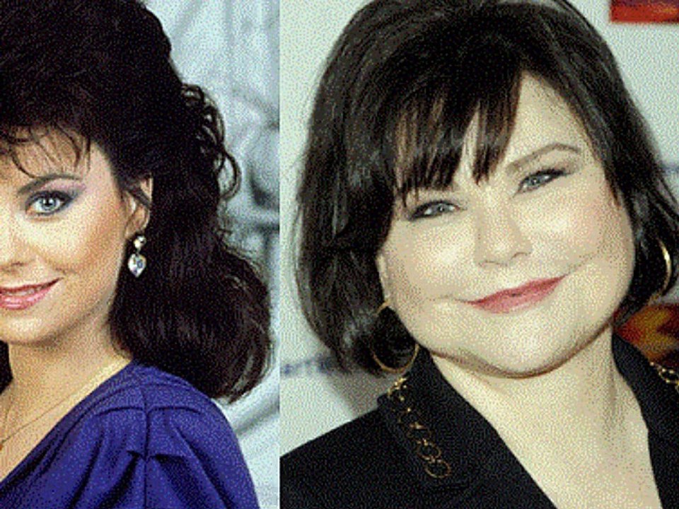 Celebrities and their Plastic Existence