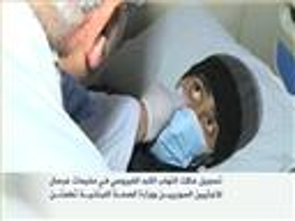 حالات التهاب الكبد الفيروسي في مخيمات عرسال للاجئين
