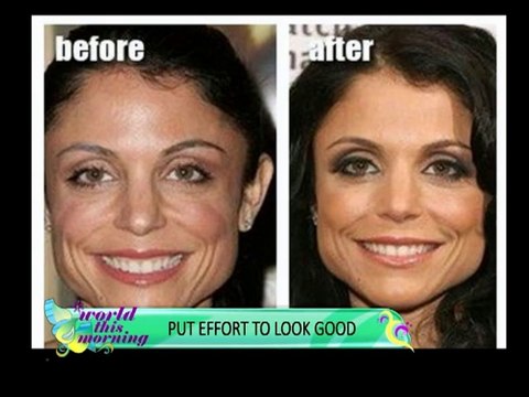 World This Morning-Plastic Surgery & Hair Transplantation