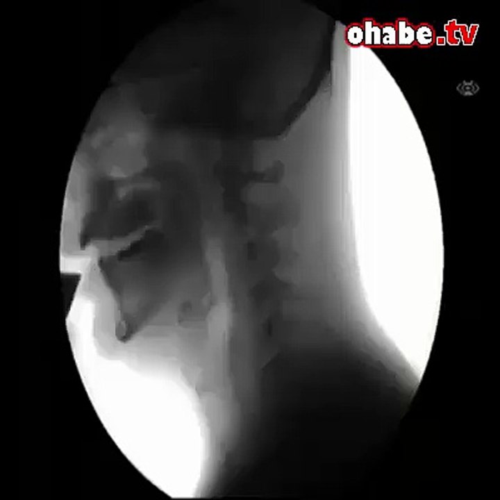 Su İçen İnsanın X-Ray Görüntüsü
