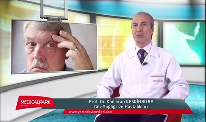 Göz Kapağı Şekil Bozuklukları Nelerdir?