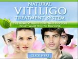 Natural Vitiligo Treatment System Reviews -  Natural Vitiligo Treatment System