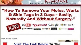 Moles Warts & Skin Tags Removal Book Review + DISCOUNT + BONUS