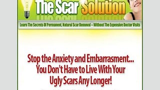 The Scar Solution - Natural Scar Removal!